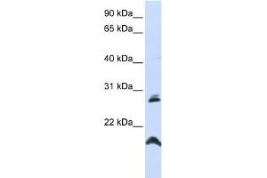 WB Suggested Anti-SPATA9 Antibody Titration:  0. (SPATA9 抗体  (N-Term))