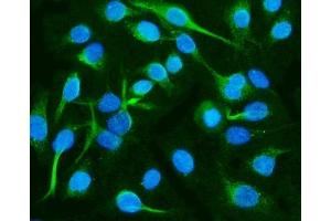 IF analysis of CRMP2/DPYSL2 using anti-CRMP2/DPYSL2 antibody (ABIN7603208).