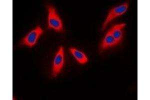 Immunofluorescent analysis of XPLN staining in MCF7 cells. (ARHGEF3 抗体  (C-Term))