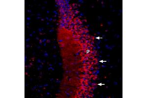 Expression of CaVβ2 in rat brain - Immunohistochemical staining of rat hippocampus using Anti-CACNB2-ATTO Fluor-594 Antibody (ABIN7042986).