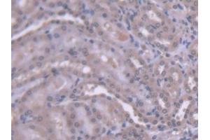 DAB staining on IHC-P; Samples: Rat Kidney Tissue (HEXB 抗体  (AA 100-216))