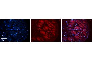 Rabbit Anti-ADAR Antibody   Formalin Fixed Paraffin Embedded Tissue: Human heart Tissue Observed Staining: Cytoplasmic Primary Antibody Concentration: 1:100 Other Working Concentrations: N/A Secondary Antibody: Donkey anti-Rabbit-Cy3 Secondary Antibody Concentration: 1:200 Magnification: 20X Exposure Time: 0.