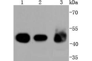 Lane 1: A431 Cell lysates, Lane 2: Mouse colon lysates, Lane 3: Mouse kidney lysates, probed with Cytokeratin 18 (1F11) Monoclonal Antibody  at 1:2000 overnight at 4˚C. (Cytokeratin 18 抗体)