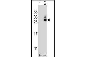 Western blot analysis of MOBKL1B (arrow) using rabbit polyclonal MOBKL1B Antibody (N-term) (ABIN656811 and ABIN2846025). (MOB1A 抗体  (N-Term))