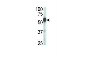 Antibody is used in Western blot to detect ZMPSTE24 in mouse cerebellum tissue lysate. (ZMPSTE24 抗体  (AA 400-430))