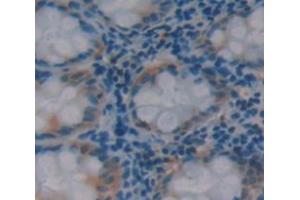 Used in DAB staining on fromalin fixed paraffin- embedded Kidney tissue (HAUS7 抗体  (AA 4-319))