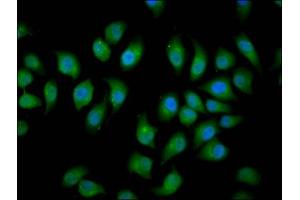 Immunofluorescence staining of A549 cells with ABIN7151037 at 1:166, counter-stained with DAPI. (HECW2 抗体  (AA 495-641))