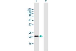 Western Blot analysis of IGJ expression in transfected 293T cell line by IGJ MaxPab polyclonal antibody. (IGJ 抗体  (AA 1-159))