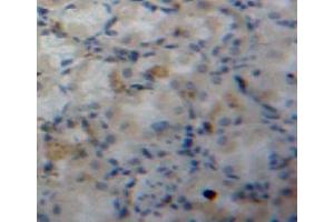 #VALUE! (FABP5 抗体  (AA 2-135))