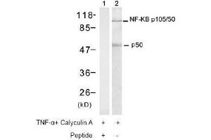 Image no. 2 for anti-Nuclear Factor of kappa Light Polypeptide Gene Enhancer in B-Cells 1 (NFKB1) (Ser337) antibody (ABIN197123) (NFKB1 抗体  (Ser337))
