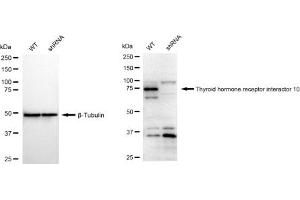 Western blotting analysis using Thyroid hormone receptor interactor 10 antibody (ABIN7800554). (Recombinant TRIP10 抗体)