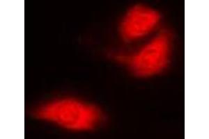 Immunofluorescent analysis of G3BP1 staining in A549 cells. (G3BP1 抗体  (Center))