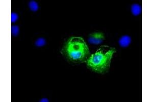 Anti-KRT8 mouse monoclonal antibody (ABIN2452349) immunofluorescent staining of COS7 cells transiently transfected by pCMV6-ENTRY KRT8 (RC209570). (KRT8 抗体  (AA 91-381))