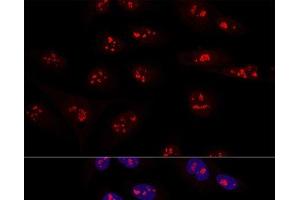 Confocal immunofluorescence analysis of U2OS cells using NOP58 Polyclonal Antibody at dilution of 1:100. (NOP58 抗体)