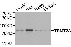 Western blot analysis of extracts of various cells, using TRMT2A antibody. (TRMT2A 抗体)