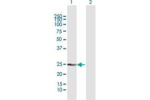 Western Blotting (WB) image for anti-Melanoregulin (MREG) (AA 1-214) antibody (ABIN527622)