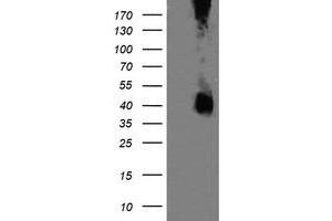 Image no. 4 for anti-Mitogen-Activated Protein Kinase Kinase 3 (MAP2K3) antibody (ABIN1499399) (MAP2K3 抗体)