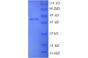 Selenoprotein P Protein (SEPP1) (AA 20-381) (His tag)