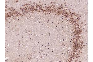 Paraformaldehyde-fixed, paraffin embedded Rat brain Antigen retrieval by boiling in sodium citrate buffer (pH6. (GLI1 抗体  (AA 601-700))