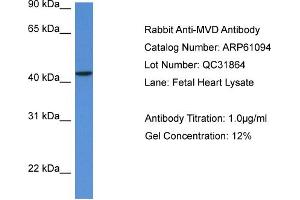 Western Blotting (WB) image for anti-Mevalonate (Diphospho) Decarboxylase (MVD) (N-Term) antibody (ABIN2774304) (MVD 抗体  (N-Term))