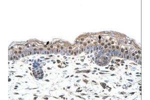 Image no. 1 for anti-Interferon Regulatory Factor 4 (IRF4) (N-Term) antibody (ABIN6737818) (IRF4 抗体  (N-Term))