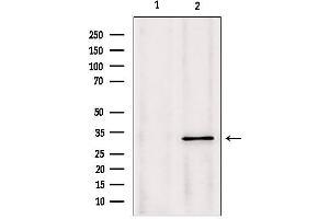 Western blot analysis of extracts from Mouse Myeloma cell, using PYCR1 antibody. (PYCR1 抗体  (Internal Region))