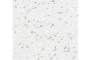 anti-Capicua Homolog (CIC) (AA 1433-1527) antibody