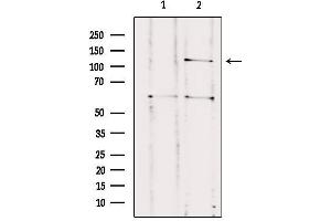 Western blot analysis of extracts from HUVEC, using CNTNAP3 Antibody. (CNTNAP3 抗体  (Internal Region))