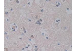 Immunohistochemistry (IHC) image for anti-Pancreas Specific Transcription Factor, 1a (PTF1A) (AA 177-328) antibody (ABIN7435103)