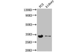 Western Blot Positive WB detected in: PC-3 whole cell lysate, Mouse kidney tissue All lanes: POLR2C antibody at 3.