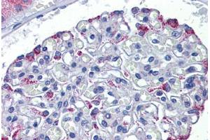 Human Kidney: Formalin-Fixed, Paraffin-Embedded (FFPE) (DSCAM 抗体  (AA 1548-1597))