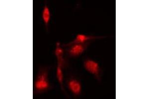 ABIN6276872 staining HeLa cells by IF/ICC. (BUB1B 抗体  (C-Term))