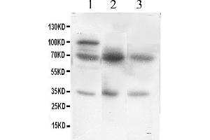 Western Blotting (WB) image for anti-Glutamate Decarboxylase 1 (Brain, 67kDa) (GAD1) (AA 14-122) antibody (ABIN3042415)