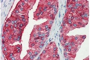 Human Prostate (formalin-fixed, paraffin-embedded) stained with MUC13 antibody ABIN351431 at 10 ug/ul followed by biotinylated goat anti-rabbit IgG secondary antibody ABIN481713, alkaline phosphatase-streptavidin and chromogen. (MUC13 抗体  (Internal Region))