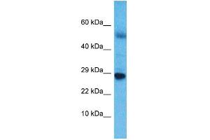 Host:  Rabbit  Target Name:  NKX6-3  Sample Type:  Esophagus Tumor lysates  Antibody Dilution:  1. (NK6 Homeobox 3 抗体  (C-Term))