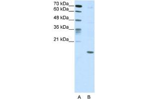 WB Suggested Anti-DUX5 Antibody Titration:  5. (DUX5 抗体  (C-Term))
