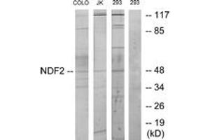 Western blot analysis of extracts from 293/COLO/Jurkat cells, using NDF2 Antibody. (NEUROD2 抗体  (AA 61-110))
