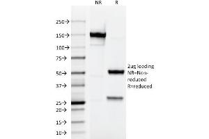 SDS-PAGE Analysis Purified Testosterone Mouse Monoclonal Antibody (4E1G2). (Testosterone 抗体)