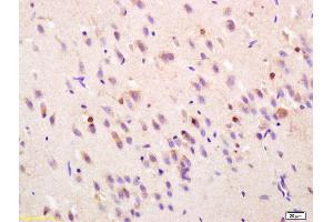 Formalin-fixed and paraffin embedded rat brain labeled with Rabbit Anti FGF1/AFGF Polyclonal Antibody, Unconjugated (ABIN726590) at 1:200 followed by conjugation to the secondary antibody and DAB staining (FGF1 抗体  (AA 16-80))