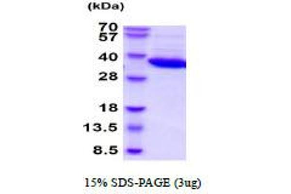 LDHB Protein (AA 1-334)