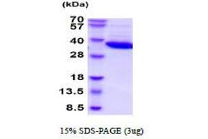 SDS-PAGE (SDS) image for Lactate Dehydrogenase B (LDHB) (AA 1-334) (Active) protein (ABIN6387839) (LDHB Protein (AA 1-334))