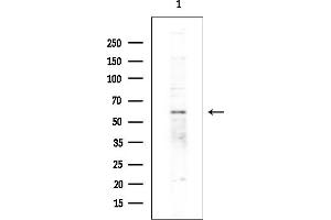 Western blot analysis of lysates from EC304 cells(heat-shock treatment), using ZNF440 Antibody at 1/1000 dilution.