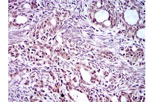 Immunohistochemistry (IHC) image for anti-Kruppel-Like Factor 1 (erythroid) (KLF1) (AA 208-362) antibody (ABIN1724828)