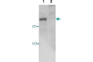 Western blot was performed on whole cell lysates from mouse fibroblasts (Lane 1, NIH/3T3) and embryonic stem cells (Lane 2, E14Tg2a) with Setd1a polyclonal antibody , diluted 1 : 500 in BSA/PBS-Tween. (SETD1A 抗体)