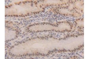 Immunohistochemistry (IHC) image for anti-Proliferating Cell Nuclear Antigen (PCNA) (AA 6-261) antibody (ABIN7443113)