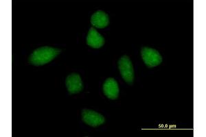 Immunofluorescence (IF) image for anti-Protein Phosphatase 1, Regulatory Subunit 13 Like (PPP1R13L) (AA 1-828) antibody (ABIN524250)