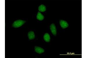 Immunofluorescence of purified MaxPab antibody to PPP1R13L on HeLa cell. (PPP1R13L 抗体  (AA 1-828))