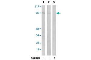 Western blot analysis of extracts from LoVo cells (Lane 1 and lane 3) and K-562 cells (Lane 2), using CHPF polyclonal antibody . (CHPF 抗体)