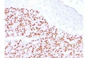 Formalin-fixed, paraffin-embedded human Thyroid stained with PAX8 Recombinant Rabbit Monoclonal Antibody (PAX8/2774R). (Recombinant PAX8 抗体  (AA 60-261))