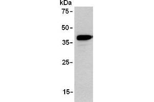 Western blot analysis of ARPP expression in TE-1 using AM26555AF-N. (ANKRD2 抗体)